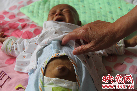 無(wú)助的小生命