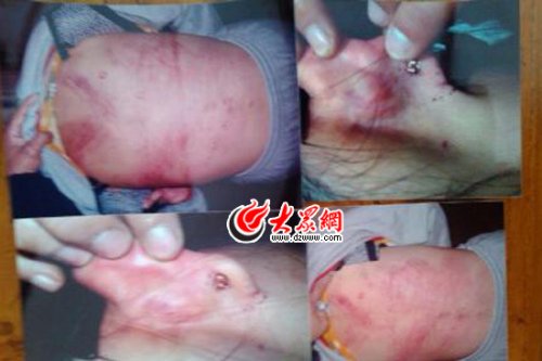 　山東藝術(shù)設(shè)計學(xué)院16歲女生宿舍內(nèi)被女同學(xué)暴打4小時。