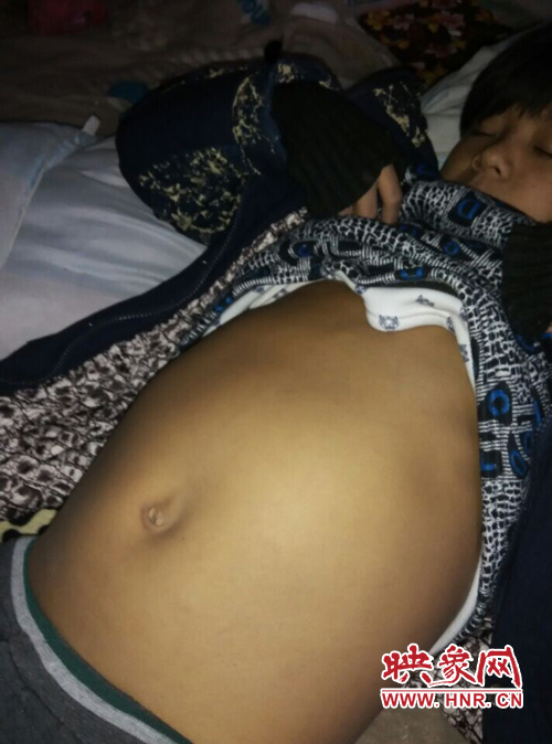 寧陵少年患病十幾年仍堅(jiān)持上學(xué) 無錢治病盼救助 寧陵少年患病十幾年仍堅(jiān)持上學(xué) 無錢治病盼救助