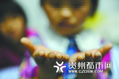 指尖被針扎得傷痕累累。