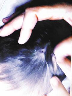 2歲女童猝死保姆家家屬質疑“傷口太離奇”（圖）