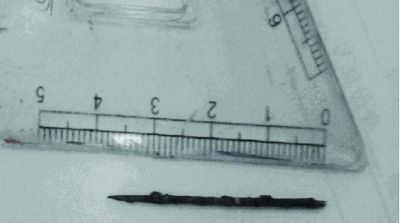 取出的繡花針已發(fā)黑生銹。