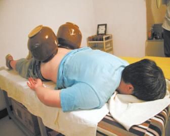 拔泡菜壇子火罐。