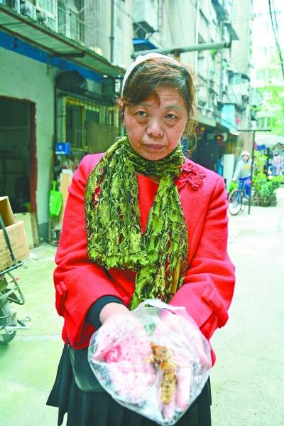 頭部受傷的黃女士展示兩根大魚(yú)刺。