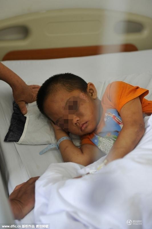 圖為全身傷痕累累的小進。