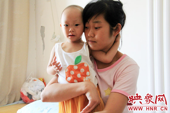 孩子和媽媽在一起，她的右眼已經(jīng)失明。