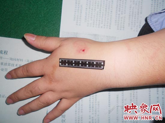 為幫助無(wú)證駕駛的朋友逃避處罰，新鄉(xiāng)的王某竟對(duì)執(zhí)勤民警大打出手，還將一名民警的手臂咬傷