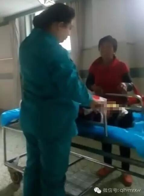 涵涵爸爸告訴《每日新聞》記者：“沒想到是熱水，大人也沒看，一時疏忽，掉進去了。抱出來的時候這個皮已經(jīng)掉了。”