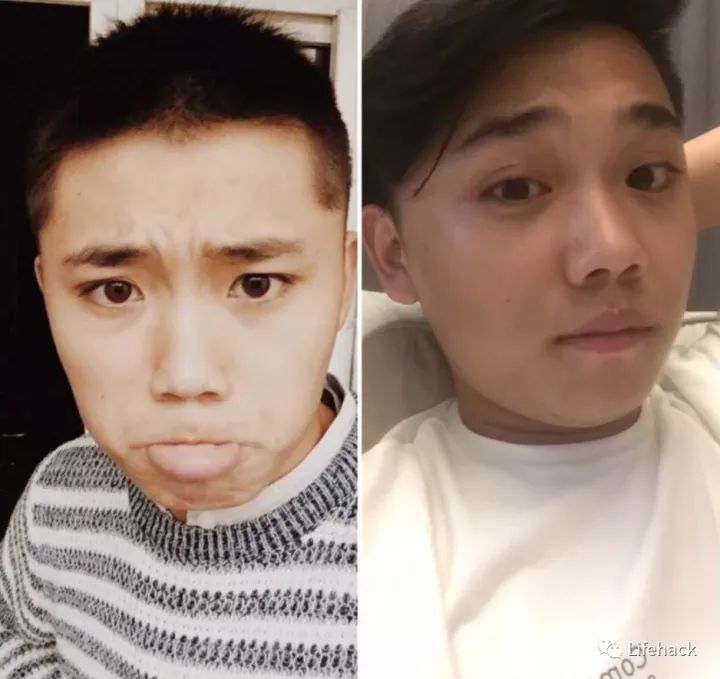 長胖20斤，臉型怎么變？這些例子看完扎心了！