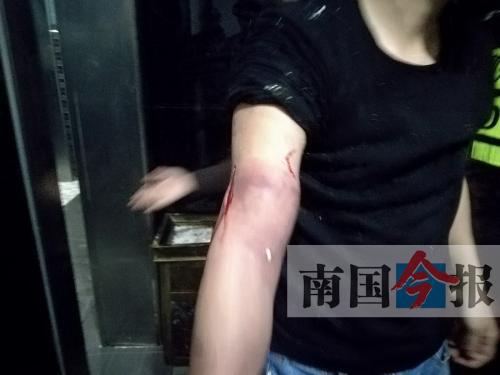 覃先生手臂被卡的部位受傷流血，所幸傷勢(shì)無(wú)大礙。 通訊員 王建民 攝