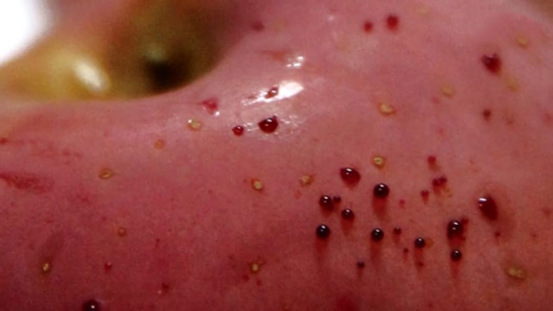 嚇懵！女子用熱水泡蘋果結(jié)果冒出血珠 咋回事？