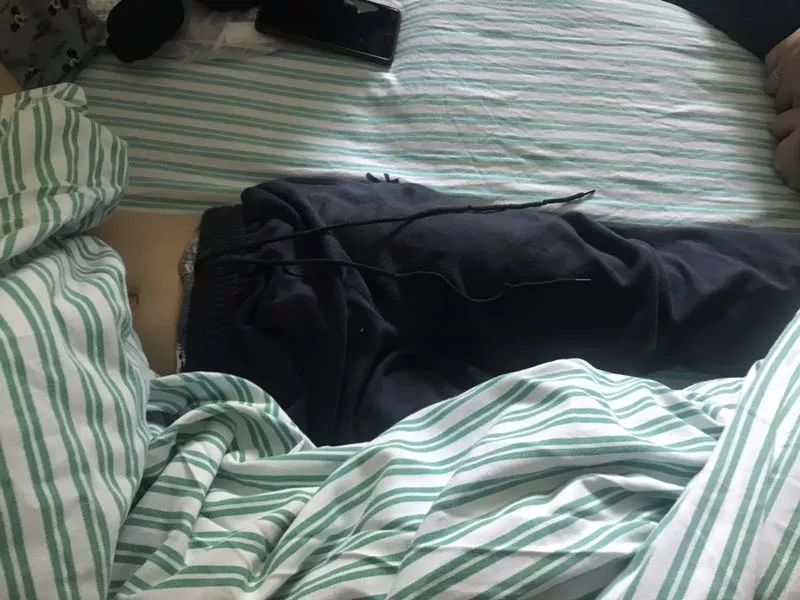 嚇哭！6歲男孩被夾斷手指 罪魁禍?zhǔn)拙故切７? oldsrc=