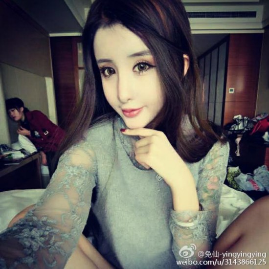 15歲少女為情整容變蛇妖 一夜爆紅 15歲少女為情整容變蛇妖 一夜爆紅