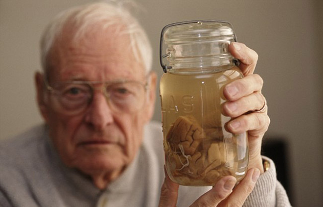 愛(ài)因斯坦大腦切片