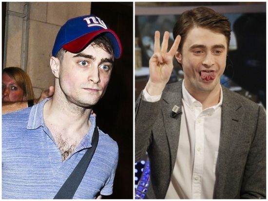 丹尼爾日前被拍到骨瘦如柴，不似2月份健康