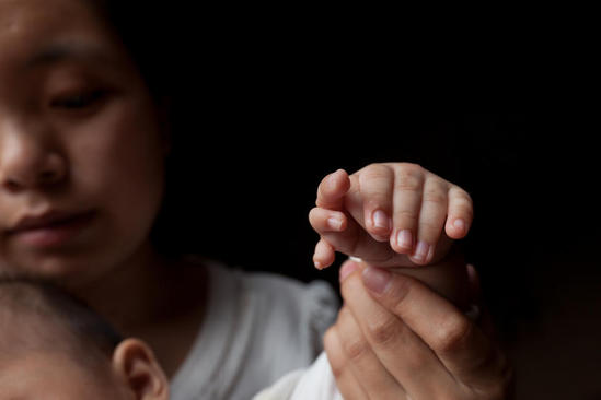 3個月大男嬰患 3個月大男嬰患