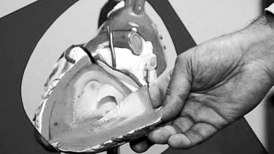 威廉斯領(lǐng)導(dǎo)的研究團(tuán)隊(duì)已經(jīng)利用人體脂肪干細(xì)胞，成功3D打印出心臟血管和心臟瓣膜，待一顆心臟的所有部件打