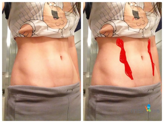 蔡依林 你的馬甲線“脫妝”了！