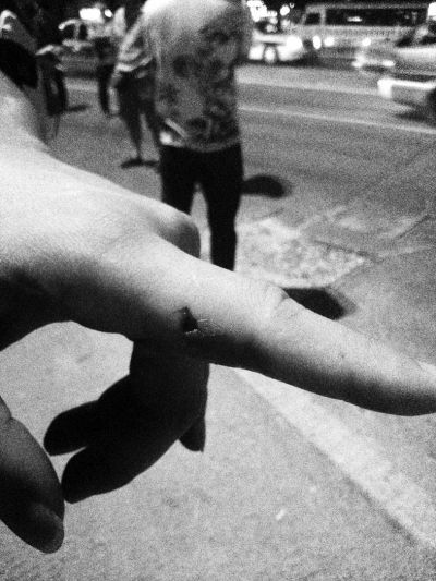 民警食指被咬傷。