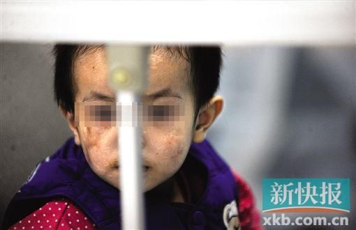 去年3月就能出院的小華(化名),目前還在廣州市婦兒醫(yī)療中心的PICU里住著。新快報記者 孫毅/攝