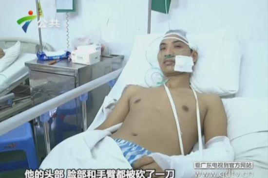 另一名傷者頭部、臉部和手臂都被砍了一刀。(視頻截圖)