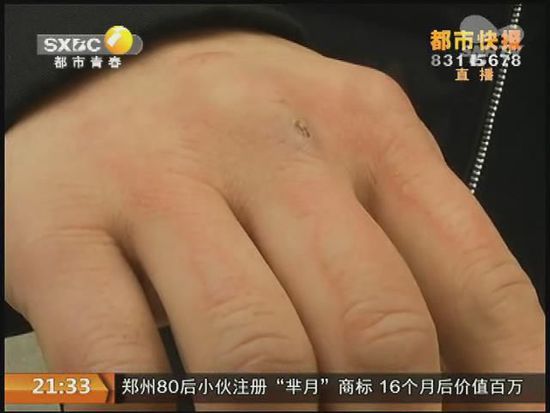 說到這足療拔罐，估計(jì)大伙都不陌生，但是想起4號(hào)晚上的拔罐的經(jīng)歷，呂先生現(xiàn)在想起來(lái)，還心有余悸。