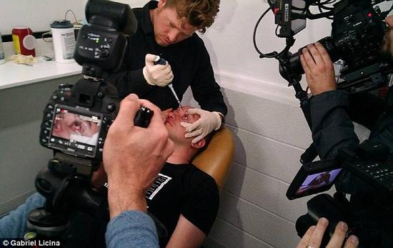 該實(shí)驗(yàn)是由加州一支名為“生物駭客”的實(shí)驗(yàn)團(tuán)隊(duì)開展的。他們使用了一種名為二氫卟吩e6（Ce6）的物質(zhì)的溶液。Ce6常見于深海魚體內(nèi)，有光敏特性，通常用于癌癥治療研究中。研究團(tuán)隊(duì)將Ce6與胰島素和鹽水混合起來，得到一種溶液，可以在低光照條件下提高人類的視力。