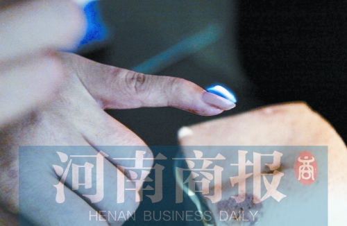 將指甲油涂在指甲上，靠近火焰時被引燃了