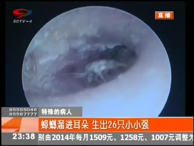 小強(qiáng)溜進(jìn)耳朵？生26只小小強(qiáng)
