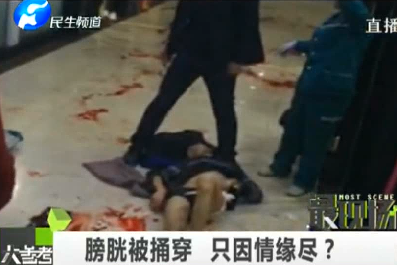 膀胱被捅穿 只因情緣盡？